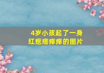 4岁小孩起了一身红疙瘩痒痒的图片