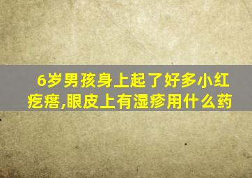 6岁男孩身上起了好多小红疙瘩,眼皮上有湿疹用什么药