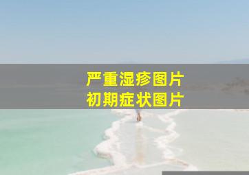 严重湿疹图片初期症状图片