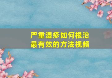 严重湿疹如何根治最有效的方法视频