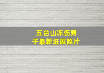 五台山冻伤男子最新进展照片