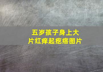 五岁孩子身上大片红痒起疙瘩图片