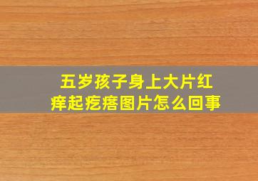 五岁孩子身上大片红痒起疙瘩图片怎么回事