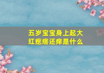 五岁宝宝身上起大红疙瘩还痒是什么