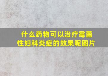 什么药物可以治疗霉菌性妇科炎症的效果呢图片