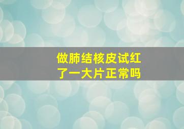 做肺结核皮试红了一大片正常吗