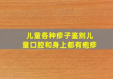 儿童各种疹子鉴别儿童口腔和身上都有疱疹