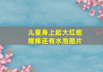 儿童身上起大红疙瘩痒还有水泡图片