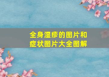 全身湿疹的图片和症状图片大全图解