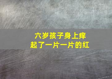 六岁孩子身上痒起了一片一片的红