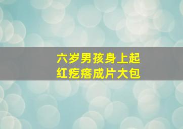 六岁男孩身上起红疙瘩成片大包