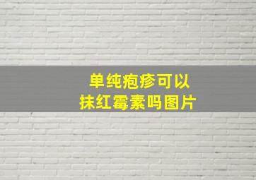 单纯疱疹可以抹红霉素吗图片