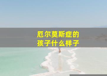 厄尔莫斯症的孩子什么样子