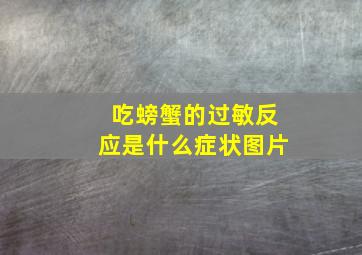 吃螃蟹的过敏反应是什么症状图片