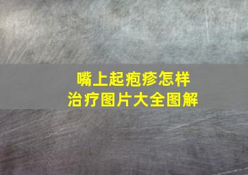 嘴上起疱疹怎样治疗图片大全图解