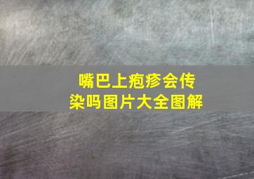 嘴巴上疱疹会传染吗图片大全图解