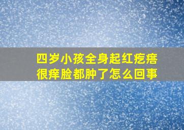 四岁小孩全身起红疙瘩很痒脸都肿了怎么回事