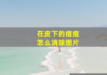 在皮下的痘痘怎么消除图片