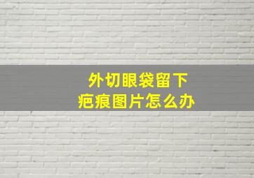 外切眼袋留下疤痕图片怎么办