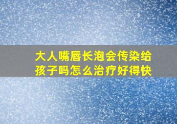 大人嘴唇长泡会传染给孩子吗怎么治疗好得快