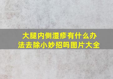 大腿内侧湿疹有什么办法去除小妙招吗图片大全