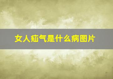 女人疝气是什么病图片