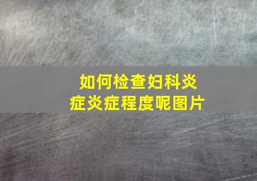 如何检查妇科炎症炎症程度呢图片