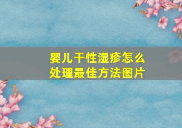 婴儿干性湿疹怎么处理最佳方法图片