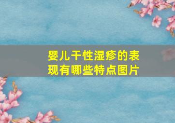 婴儿干性湿疹的表现有哪些特点图片