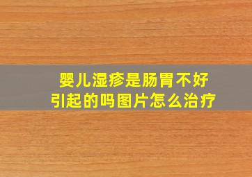 婴儿湿疹是肠胃不好引起的吗图片怎么治疗