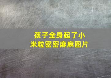 孩子全身起了小米粒密密麻麻图片