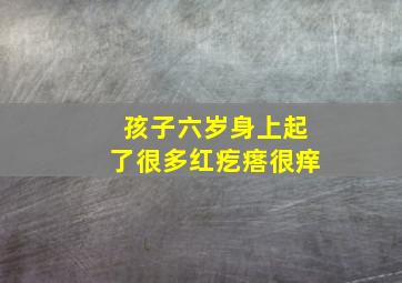 孩子六岁身上起了很多红疙瘩很痒