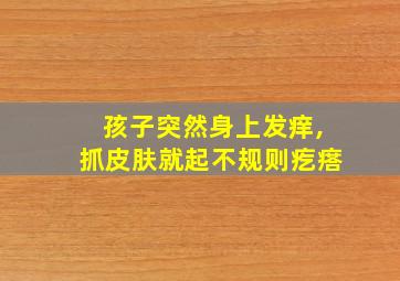 孩子突然身上发痒,抓皮肤就起不规则疙瘩