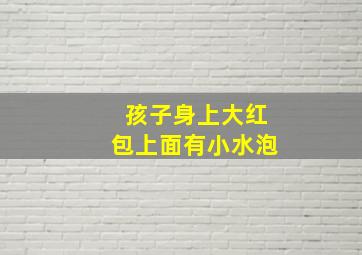 孩子身上大红包上面有小水泡