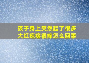 孩子身上突然起了很多大红疙瘩很痒怎么回事