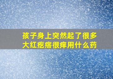 孩子身上突然起了很多大红疙瘩很痒用什么药