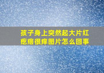 孩子身上突然起大片红疙瘩很痒图片怎么回事