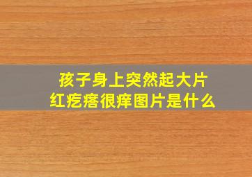 孩子身上突然起大片红疙瘩很痒图片是什么