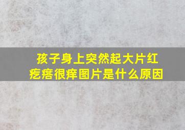 孩子身上突然起大片红疙瘩很痒图片是什么原因