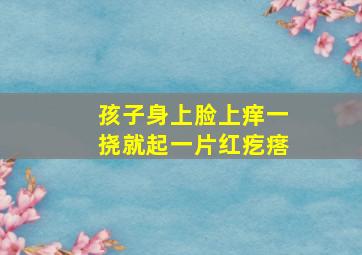 孩子身上脸上痒一挠就起一片红疙瘩