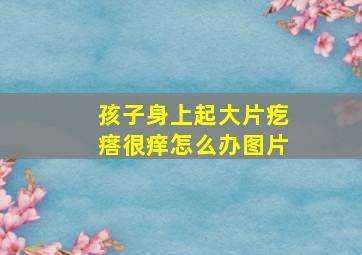 孩子身上起大片疙瘩很痒怎么办图片