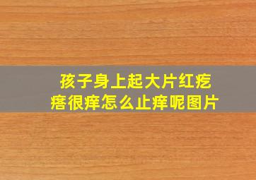 孩子身上起大片红疙瘩很痒怎么止痒呢图片