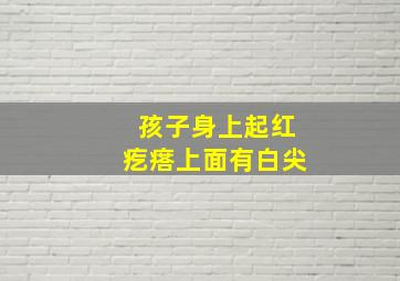 孩子身上起红疙瘩上面有白尖