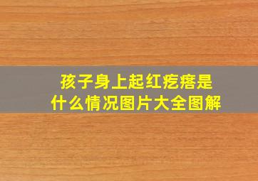 孩子身上起红疙瘩是什么情况图片大全图解