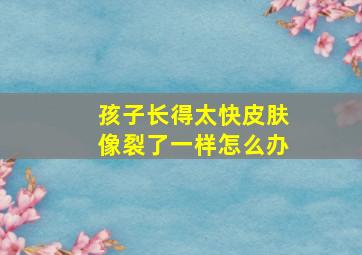 孩子长得太快皮肤像裂了一样怎么办