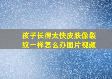 孩子长得太快皮肤像裂纹一样怎么办图片视频