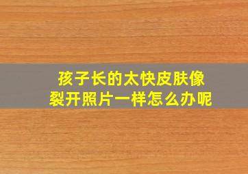 孩子长的太快皮肤像裂开照片一样怎么办呢