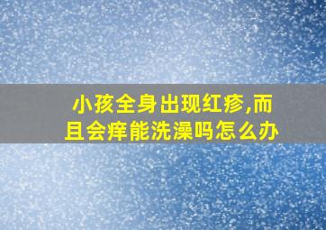 小孩全身出现红疹,而且会痒能洗澡吗怎么办