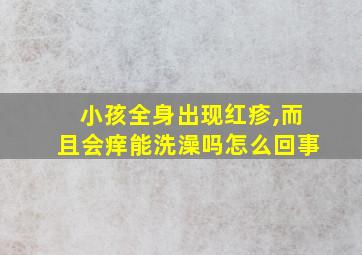 小孩全身出现红疹,而且会痒能洗澡吗怎么回事