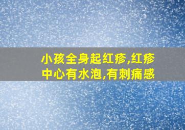 小孩全身起红疹,红疹中心有水泡,有刺痛感